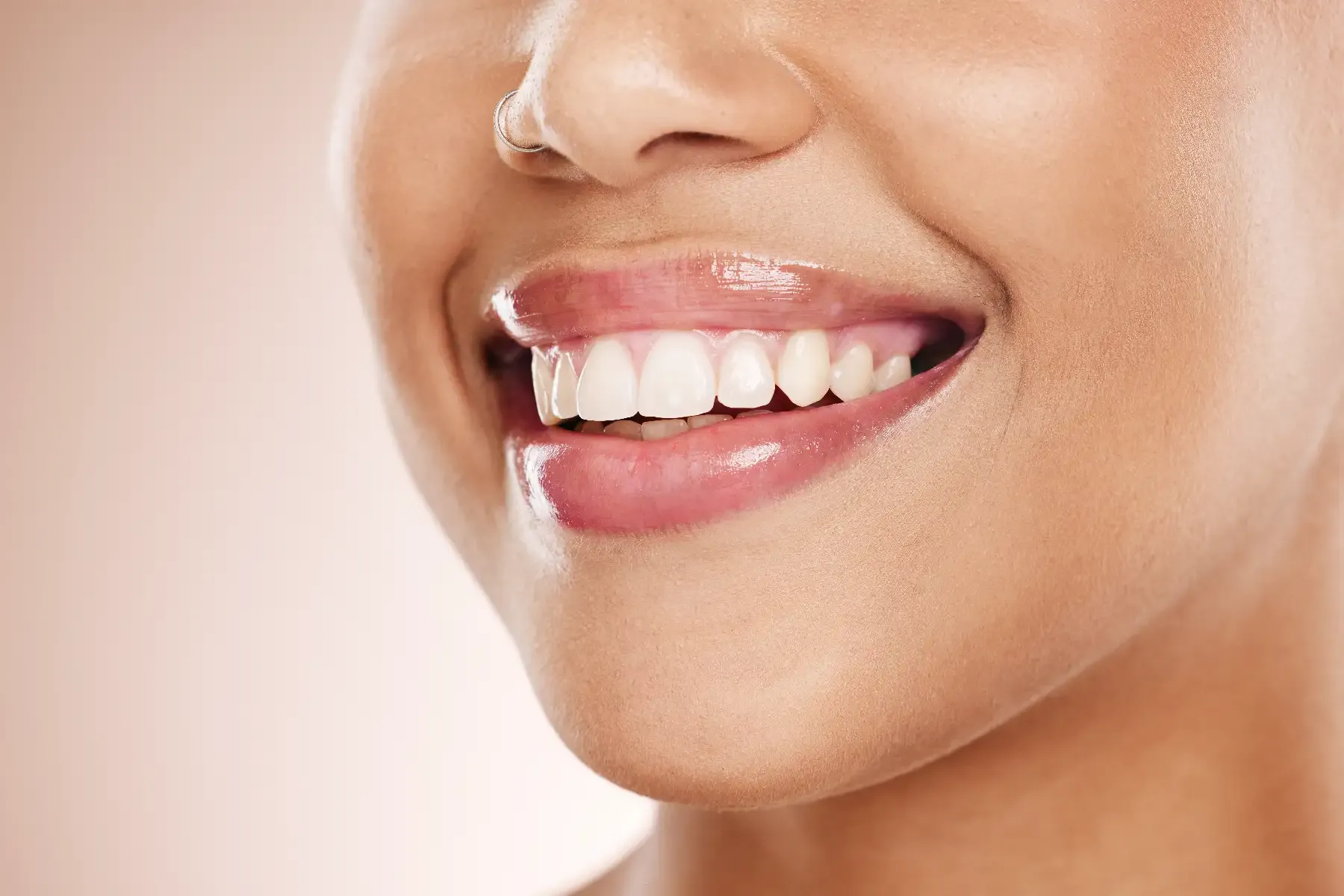 Does fluoride whiten teeth? The truth about a common misconception