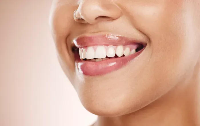 A healthy, even smile after cosmetic dentistry at Creekside Dental Langley